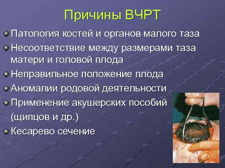 Причины ВЧРТ Патология костей и органов малого таза Несоответствие между размерами таза матери и