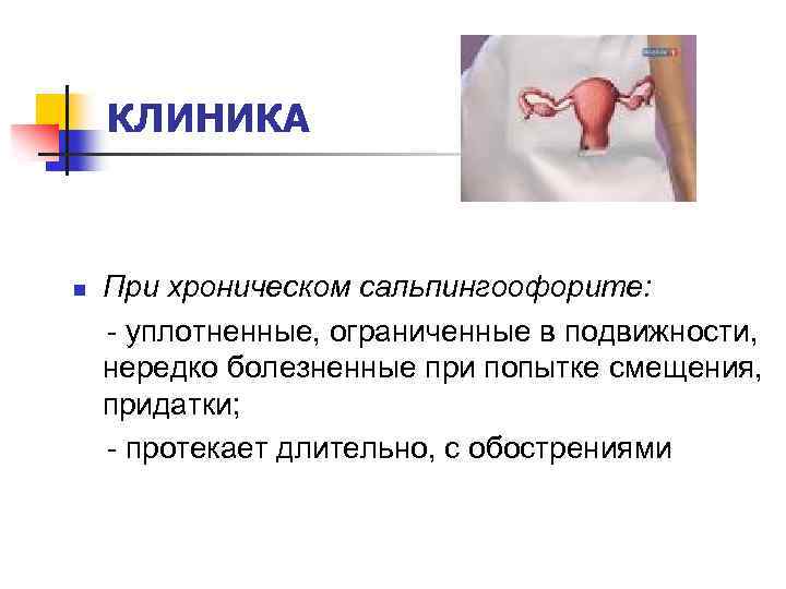 КЛИНИКА n При хроническом сальпингоофорите: - уплотненные, ограниченные в подвижности, нередко болезненные при попытке
