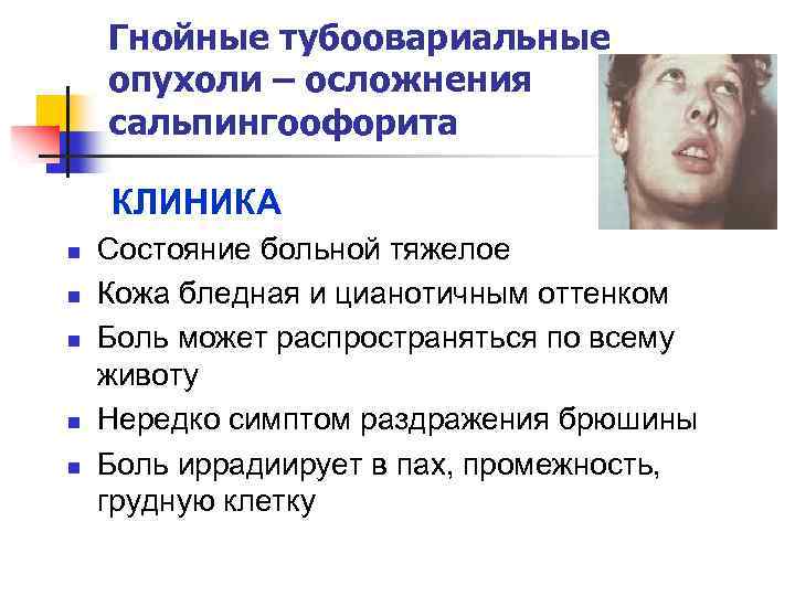 Гнойные тубоовариальные опухоли – осложнения сальпингоофорита КЛИНИКА n n n Состояние больной тяжелое Кожа