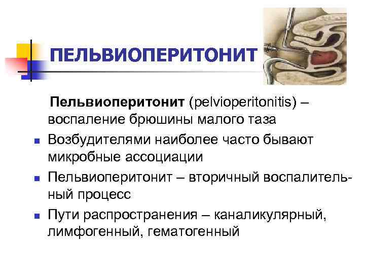 ПЕЛЬВИОПЕРИТОНИТ n n n Пельвиоперитонит (pelvioperitonitis) – воспаление брюшины малого таза Возбудителями наиболее часто