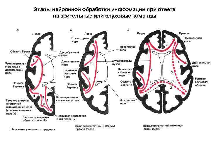 Этапы нейронной обработки информации при ответе на зрительные или слуховые команды 