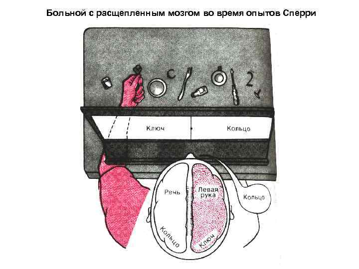 Больной с расщепленным мозгом во время опытов Сперри 