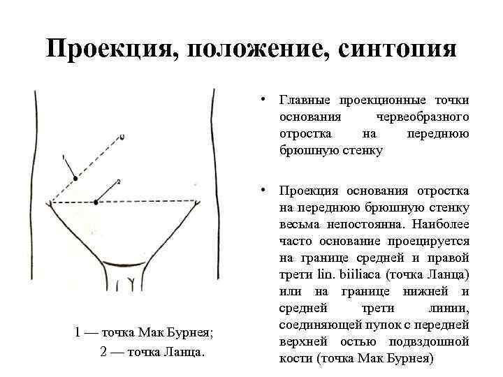 Проекция, положение, синтопия • Главные проекционные точки основания червеобразного отростка на переднюю брюшную стенку