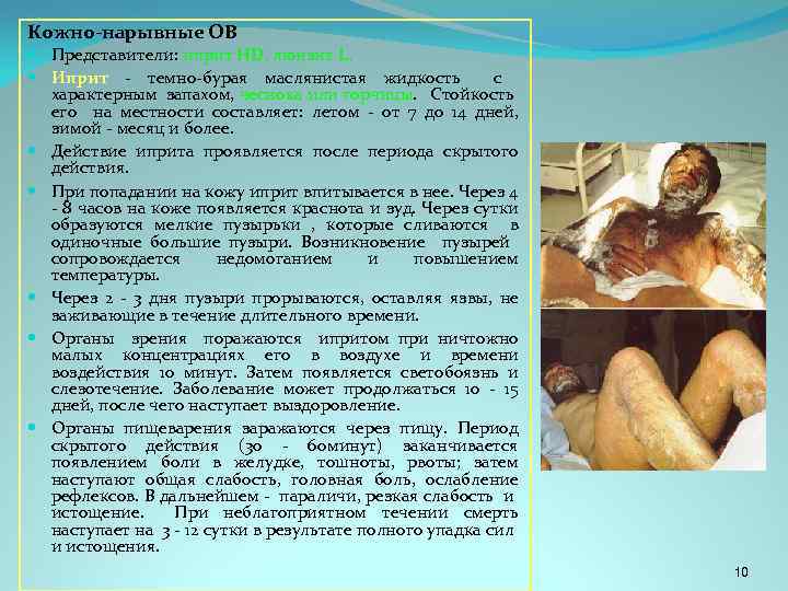 Кожно-нарывные ОВ Представители: иприт HD, люизит L, Иприт - темно-бурая маслянистая жидкость с характерным