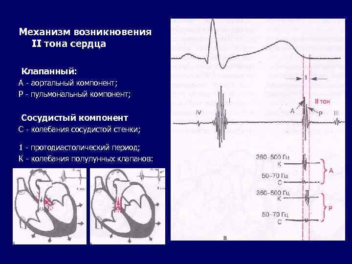 1 тон сердца. Систолический тон сердца компоненты. Механизм возникновения 1 тона сердца пропедевтика. Аускультация 2 тона сердца. Сосудистый компонент II тона сердца обусловлен колебаниями:.