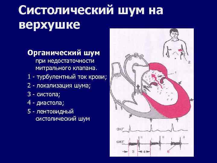 Аускультация сердца пропедевтика презентация