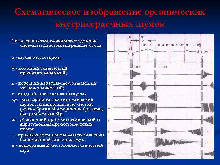 Схематическое изображение органических внутрисердечных шумов 1 -6 -исторически сложившееся деление систолы и диастолы на