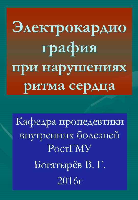 Электрокардио графия при нарушениях ритма сердца Кафедра пропедевтики внутренних болезней Рост. ГМУ Богатырёв В.