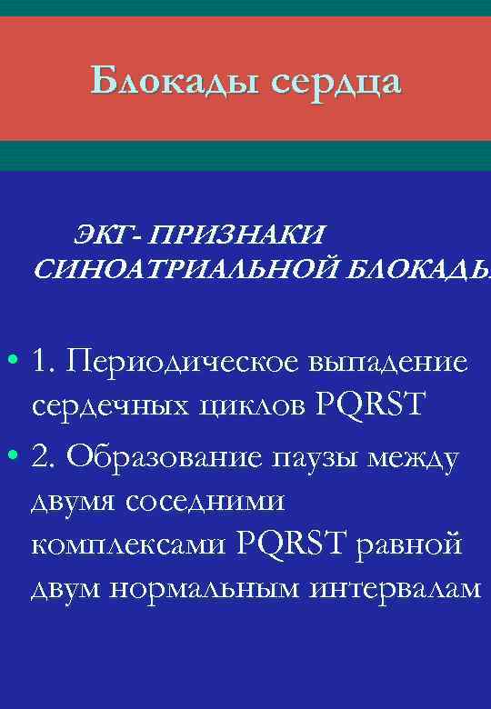 Блокады сердца ЭКГ- ПРИЗНАКИ СИНОАТРИАЛЬНОЙ БЛОКАДЫ • 1. Периодическое выпадение сердечных циклов РQRST •