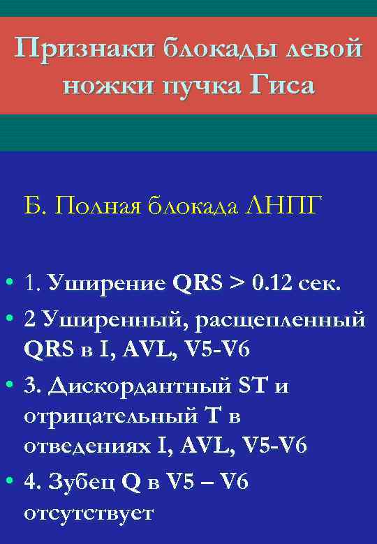 Признаки блокады левой ножки пучка Гиса Б. Полная блокада ЛНПГ • 1. Уширение QRS