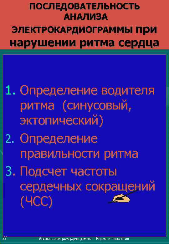 ПОСЛЕДОВАТЕЛЬНОСТЬ АНАЛИЗА ЭЛЕКТРОКАРДИОГРАММЫ при нарушении ритма сердца 1. Определение водителя ритма (синусовый, эктопический) 2.