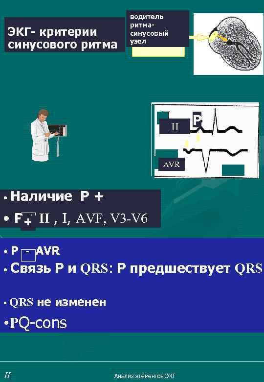 ЭКГ- критерии синусового ритма водитель ритмасинусовый узел II Р AVR • Наличие Р+ •