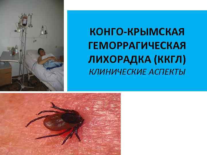 КОНГО-КРЫМСКАЯ ГЕМОРРАГИЧЕСКАЯ ЛИХОРАДКА (ККГЛ) КЛИНИЧЕСКИЕ АСПЕКТЫ 