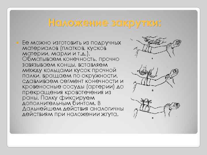 Наложение закрутки: Ее можно изготовить из подручных материалов (платков, кусков материи, марли и т.