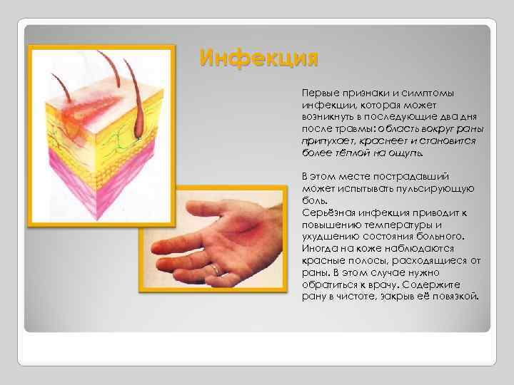 Инфекция Первые признаки и симптомы инфекции, которая может возникнуть в последующие два дня после