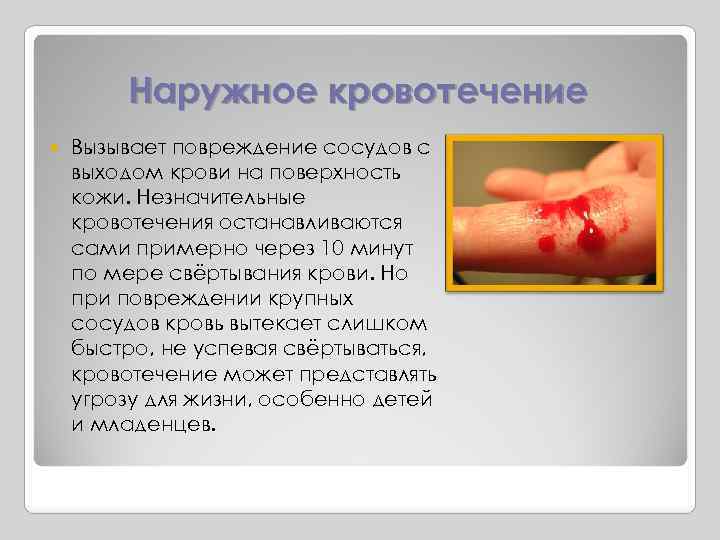 Наружное кровотечение Вызывает повреждение сосудов с выходом крови на поверхность кожи. Незначительные кровотечения останавливаются