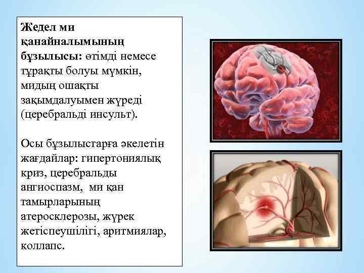 Жедел ми қанайналымының бұзылысы: өтімді немесе тұрақты болуы мүмкін, мидың ошақты зақымдалуымен жүреді (церебральді