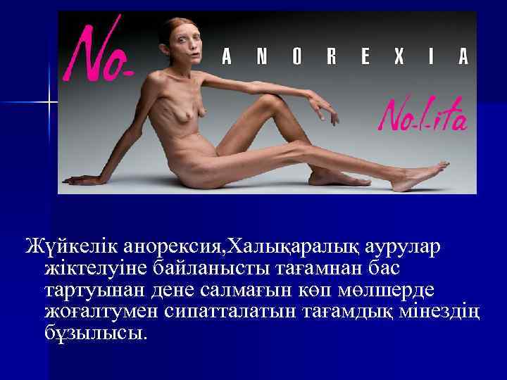 Жүйкелік анорексия, Халықаралық аурулар жіктелуіне байланысты тағамнан бас тартуынан дене салмағын көп мөлшерде жоғалтумен