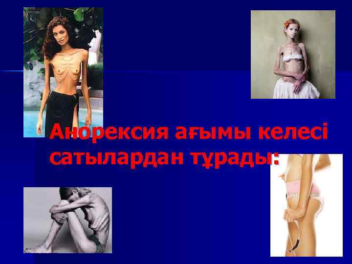 Анорексия ағымы келесі сатылардан тұрады: 