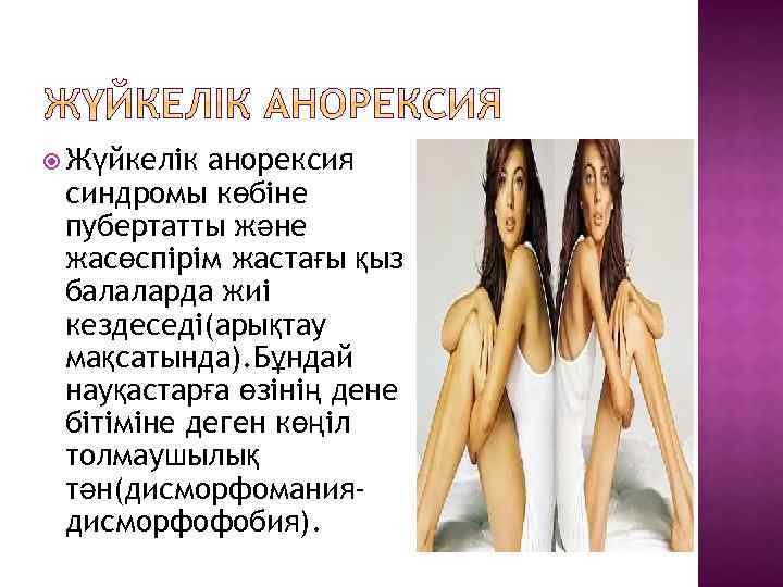  Жүйкелік анорексия синдромы көбіне пубертатты және жасөспірім жастағы қыз балаларда жиі кездеседі(арықтау мақсатында).