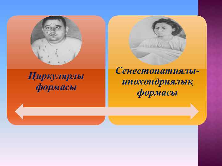 Циркулярлы формасы Сенестопатиялыипохондриялық формасы 