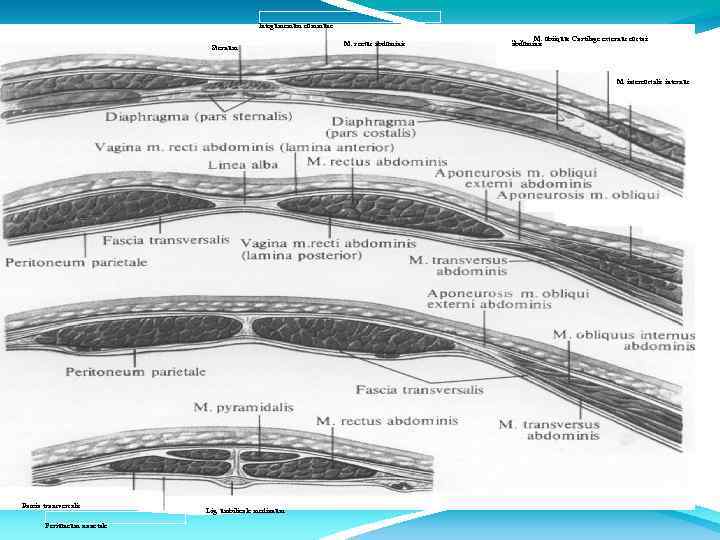 lntegumemum commune Sternum M. rectus abdominis „ . , M. obiiquus Cartilage externus costais