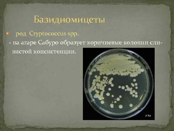 Базидиомицеты род Cryptococcus spp. - на агаре Сабуро образует коричневые колонии слизистой консистенции. 