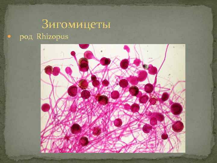 Зигомицеты род Rhizopus 