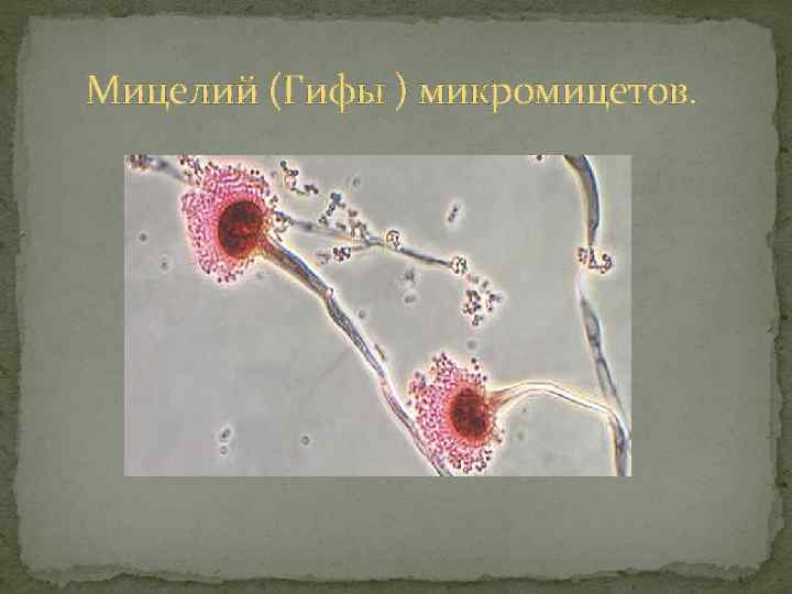 Мицелий (Гифы ) микромицетов. 