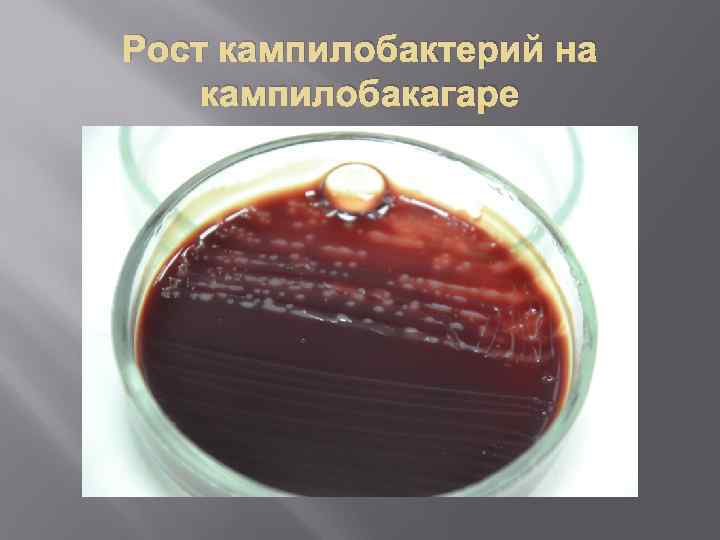 Рост кампилобактерий на кампилобакагаре 