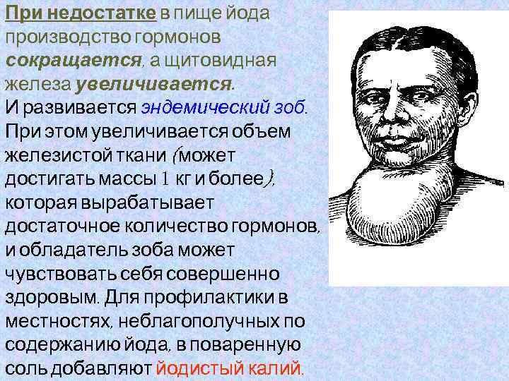 При недостатке в пище йода производство гормонов сокращается, а щитовидная железа увеличивается. И развивается