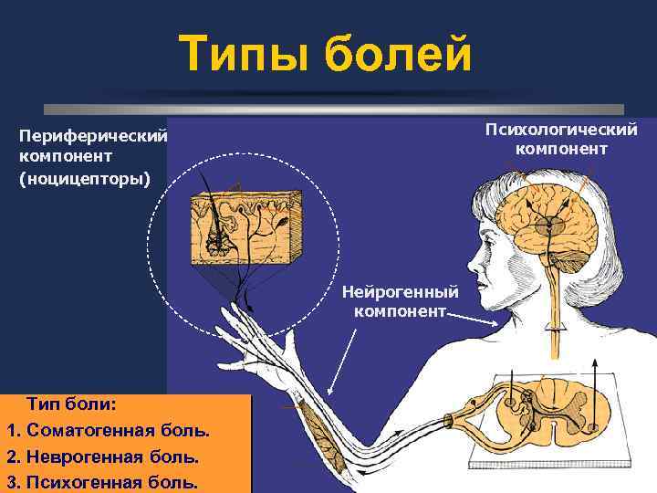 Типы болей Психологический компонент Периферический компонент (ноцицепторы) Нейрогенный компонент ДОРСАЛЬНЫЙ РОГ Тип боли: 1.