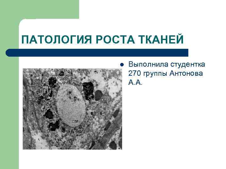 ПАТОЛОГИЯ РОСТА ТКАНЕЙ l Выполнила студентка 270 группы Антонова А. А. 