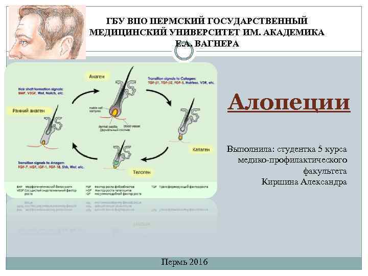 ГБУ ВПО ПЕРМСКИЙ ГОСУДАРСТВЕННЫЙ МЕДИЦИНСКИЙ УНИВЕРСИТЕТ ИМ. АКАДЕМИКА Е. А. ВАГНЕРА Алопеции Выполнила: студентка