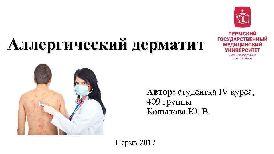 Аллергический дерматит Автор: студентка IV курса, 409 группы Копылова Ю. В. Пермь 2017 