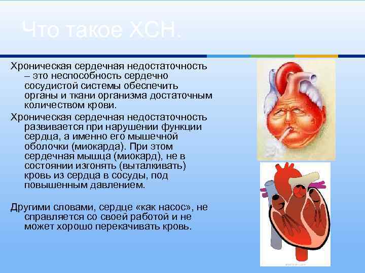 Что такое ХСН. Хроническая сердечная недостаточность – это неспособность сердечно сосудистой системы обеспечить органы