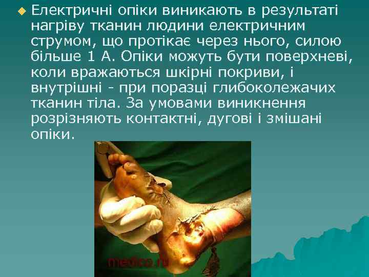 u Електричні опіки виникають в результаті нагріву тканин людини електричним струмом, що протікає через