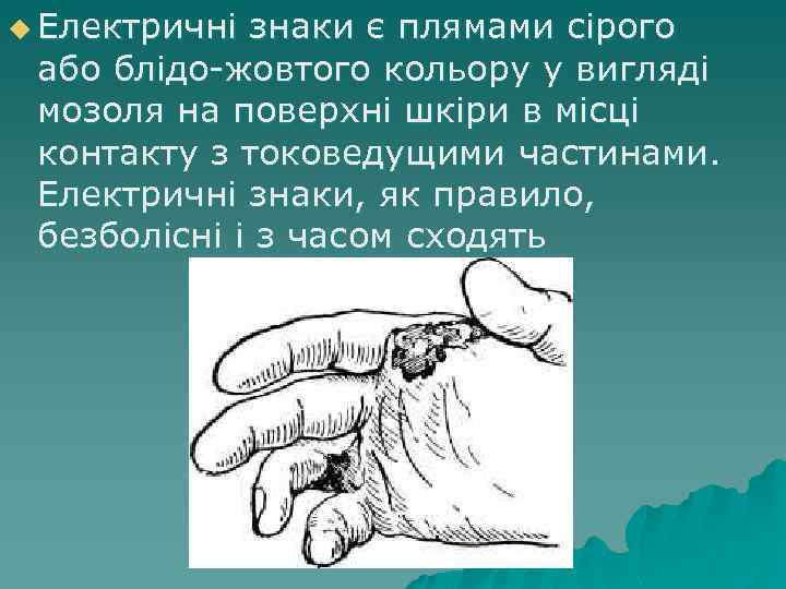u Електричні знаки є плямами сірого або блідо-жовтого кольору у вигляді мозоля на поверхні