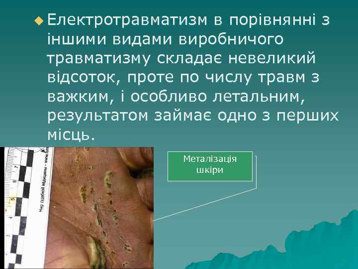 u Електротравматизм в порівнянні з іншими видами виробничого травматизму складає невеликий відсоток, проте по