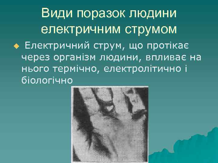 Види поразок людини електричним струмом u Електричний струм, що протікає через організм людини, впливає