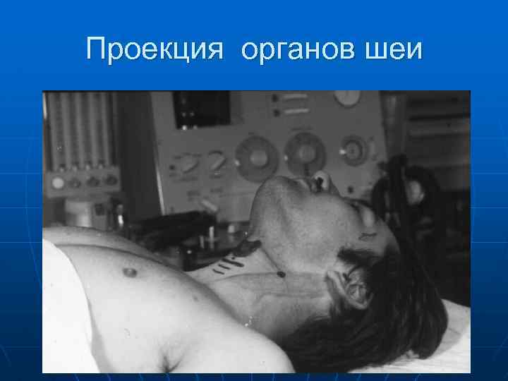 Проекция органов шеи 