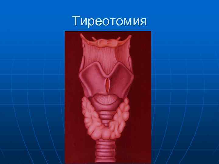 Трахеостомия топографическая анатомия презентация