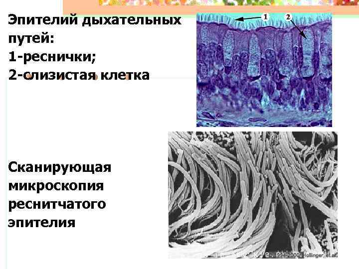 Эпителий дыхательных путей: 1 -реснички; 2 -слизистая клетка Сканирующая микроскопия реснитчатого эпителия 
