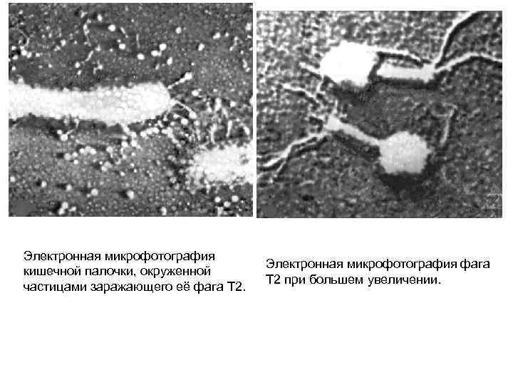 Электронная микрофотография кишечной палочки, окруженной частицами заражающего её фага Т 2. Электронная микрофотография фага
