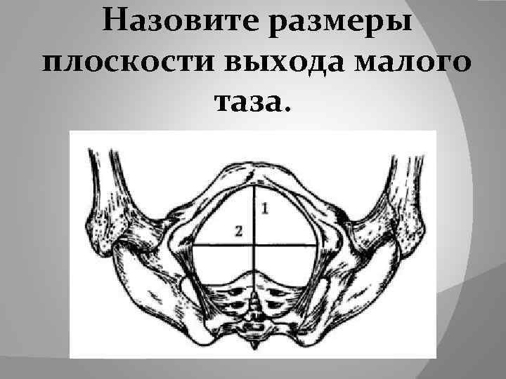  Назовите размеры плоскости выхода малого таза. 