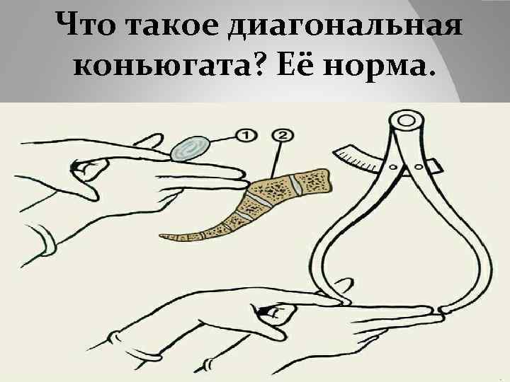  Что такое диагональная коньюгата? Её норма. 