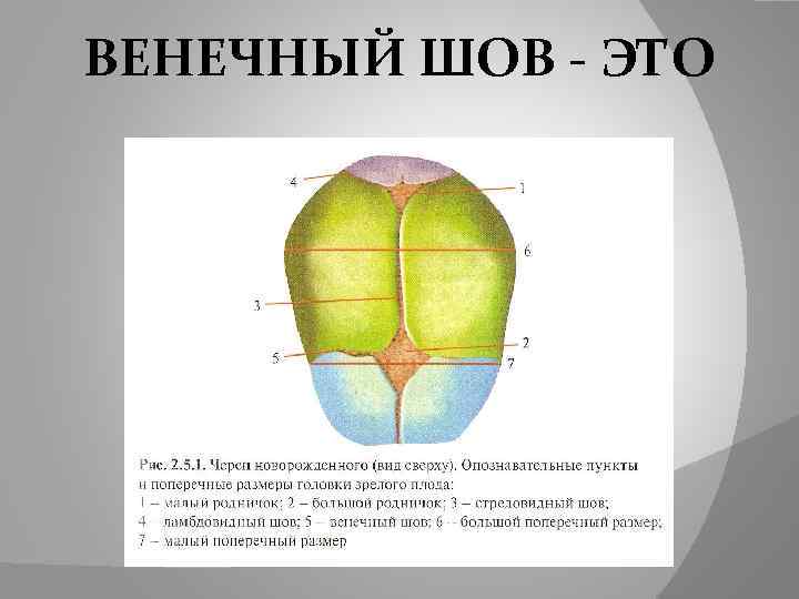 ВЕНЕЧНЫЙ ШОВ - ЭТО 
