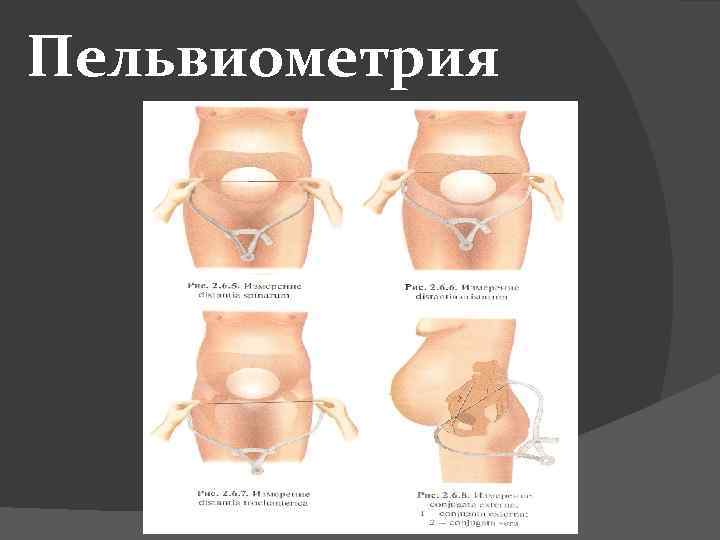 Пельвиометрия 