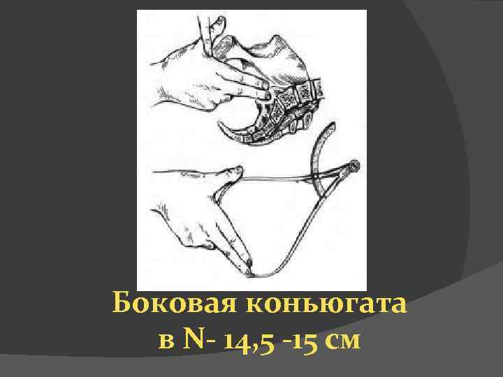 Боковая коньюгата в N- 14, 5 -15 см 