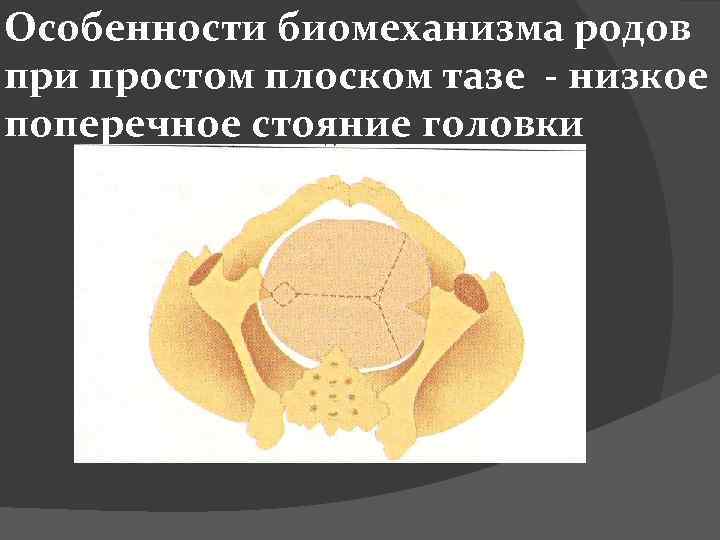 Особенности биомеханизма родов при простом плоском тазе - низкое поперечное стояние головки 